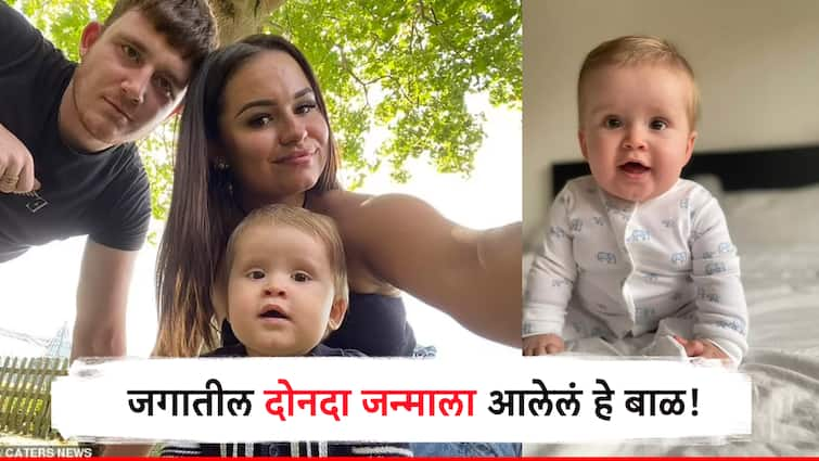 Twice Born Baby baby born twice Pregnancy story spina bifida  International News Trending Story Science Twice Born Baby: दोनवेळा जन्माला आलेलं जगातलं पहिलं बाळ! आईच्या गर्भातून काढून पुन्हा ठेवलं गर्भात, विज्ञानाच्या चमत्काराची जगभर चर्चा