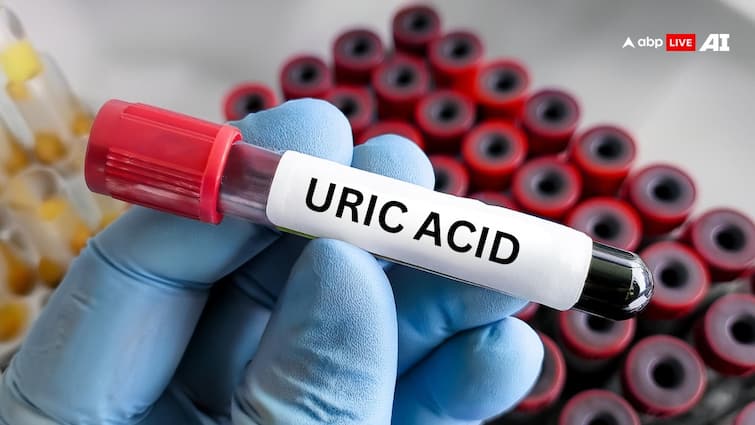 uric-acid-symptoms-in-feet-know-home-remedies-and-how-to-control Uric Acid: ਪੈਰਾਂ 'ਤੇ ਨਜ਼ਰ ਆਉਣ ਲੱਗ ਜਾਣ ਇਹ ਲੱਛਣ ਤਾਂ ਸਮਝ ਲਓ ਹੋ ਗਈ ਯੂਰਿਕ ਐਸਿਡ ਦੀ ਸਮੱਸਿਆ, ਤੁਰੰਤ ਚੈੱਕ ਕਰਵਾਓ