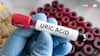 Uric Acid: पैरों पर दिखने लगे हैं ये लक्षण तो समझ जाएं हो गई यूरिक एसिड की समस्या, तुरंत करें चेक
