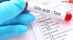 Uric Acid: ਵੱਧ ਗਿਆ ਯੂਰਿਕ ਐਸਿਡ ਤਾਂ ਭੁੱਲ ਕੇ ਵੀ ਨਾ ਖਾਓ ਆਹ ਦਾਲਾਂ, ਨਹੀਂ ਤਾਂ ਹੋ ਸਕਦੀ ਪਰੇਸ਼ਾਨੀ