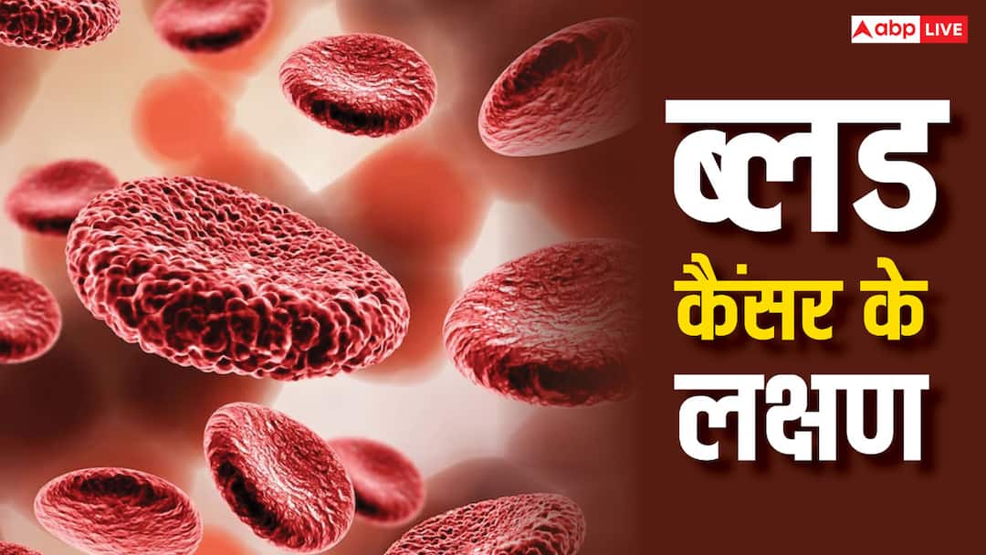 early detection means a good prognosis when it comes to blood cancers Blood Cancer: रात में बार-बार बुखार के साथ पसीना आना ब्लड कैंसर के हो सकते हैं शुरुआती लक्षण