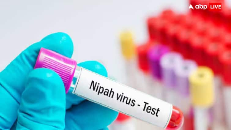 health tips nipah virus symptoms prevention and treatment process in hindi Nipah Virus: कितने दिन में ठीक हो जाता है निपाह वायरस का मरीज? जानें कैसे होता है इसका इलाज