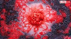 दुनिया में तेजी से फैल रही ये गंभीर बीमारी, साल 2050 तक  4 करोड़ लोगों की जा सकती है जान!