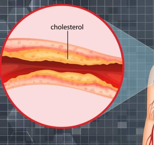 Let us learn about some such foods as maintaining healthy cholesterol levels is essential for maintaining overall health.