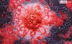 ਦੁਨੀਆ 'ਚ ਤੇਜ਼ੀ ਨਾਲ ਫੈਲ ਰਹੀ ਹੈ ਇਹ ਗੰਭੀਰ ਬੀਮਾਰੀ, ਸਾਲ 2050 ਤੱਕ 4 ਕਰੋੜ ਲੋਕਾਂ ਦੀ ਹੋ ਸਕਦੀ ਮੌਤ !