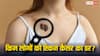 Skin Cancer: किन लोगों को सबसे ज्यादा होता है स्किन कैंसर, जानें क्या होता है कारण