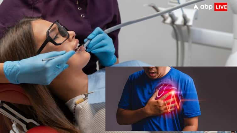 Can Root Canal Treatment Cause Heart Attack, Do You Know The Truth?