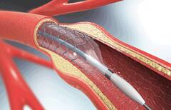 Heart 'ਚ ਬਲਾਕੇਜ ਹੋਣ 'ਤੇ ਸਰੀਰ 'ਚ ਨਜ਼ਰ ਆਉਂਦੇ ਆਹ ਲੱਛਣ, ਭੁੱਲ ਕੇ ਵੀ ਨਾ ਕਰੋ ਨਜ਼ਰਅੰਦਾਜ਼