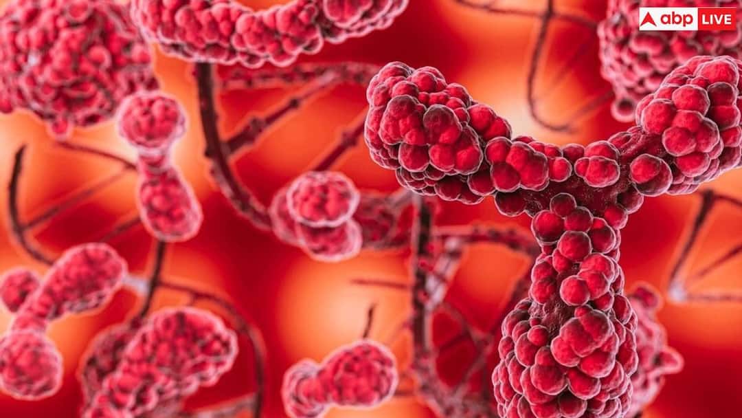 पेट में गैस और सीने में जलन कोलोरेक्टल कैंसर के हो सकते हैं लक्षण, जानिए कैसे खुद को बचाएं? warning signs of colorectal cancer and learn proactive steps to protect your health पेट में गैस और सीने में जलन कोलोरेक्टल कैंसर के हो सकते हैं लक्षण, जानिए कैसे खुद को बचाएं?