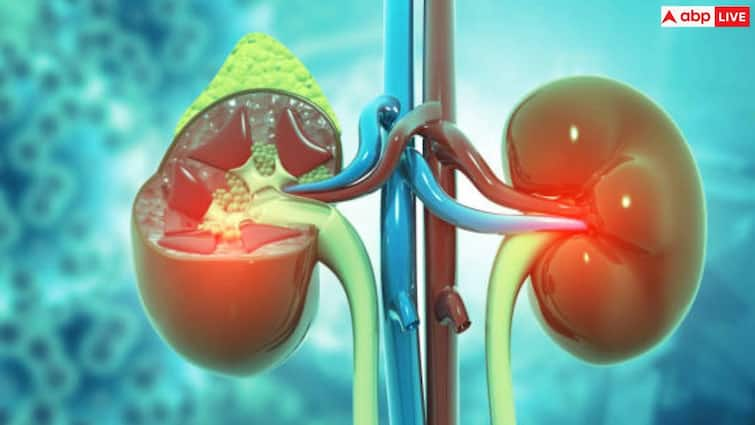 Is there a risk of kidney disease due to obesity? Read the full research