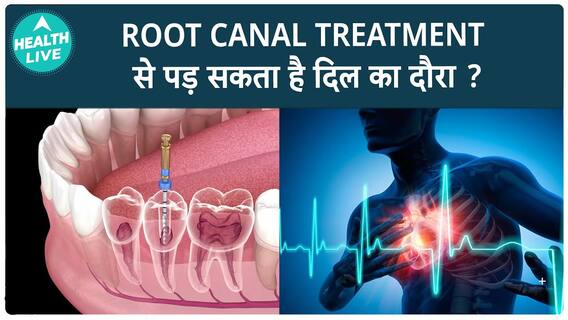 Root Canal Treatment: Could It Be Putting You At Greater Risk For Heart Attacks | Health Live