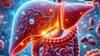 Fatty Liver: फैटी लिवर के कारण हो सकती है गंभीर स्वास्थ्य समस्याएं, जानिए कैसे रखें इसे हेल्दी