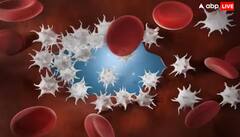 ਸਰੀਰ 'ਚ Platelets ਘੱਟ ਹੋਣ 'ਤੇ ਨਜ਼ਰ ਆਉਂਦੇ ਆਹ ਲੱਛਣ, ਇਦਾਂ ਕਰੋ ਬਚਾਅ