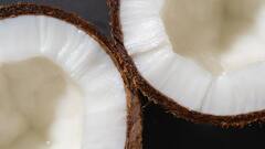 Coconut Benefits: রোজ পাতে থাক কুচি নারকেল, দূর হবে যে সমস্যাগুলি