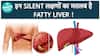 Are You Experiencing These Symptoms? It Could Be A Sign Of Fatty Liver Disease | Health Live