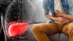 ਘਾਤਕ ਕੈਂਸਰ ਦੇ ਖ਼ਤਰੇ ਨੂੰ ਕਈ ਗੁਣਾਂ ਵਧਾ ਦਿੰਦੀ ਹੈ ਸ਼ਰਾਬ, ਰਿਸਰਚ ਵਿਚ ਵੱਡਾ ਖੁਲਾਸਾ...