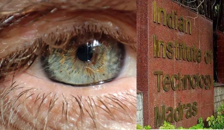 IIT Madras Researchers Identify Enhanced Drug Delivery Method for Eye Treatments அபாரம்.. கண் சிகிச்சையில் நூதன மருந்து செலுத்தும் முறை: ஐஐடி சென்னை அசத்தல்!