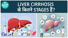 लीवर सिरोसिस के लक्षण कैसे दिखते हैं | Liver Cirrhosis | Health Live