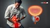 Prostate Cancer: Know About Risk Factors, Early Detections, Treatments And More