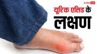 Uric Acid: क्या आप हाई यूरिक एसिड से परेशान हैं? जोड़ों के दर्द से राहत पाने के लिए अपनी डाइट में शामिल करें ये चीजें