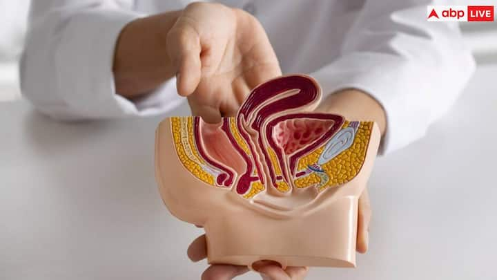 When high cholesterol increases, blood circulation in the intestine is greatly affected. This is why blood may also appear in the stool. Frequent, forceful bowel movements may be a sign.