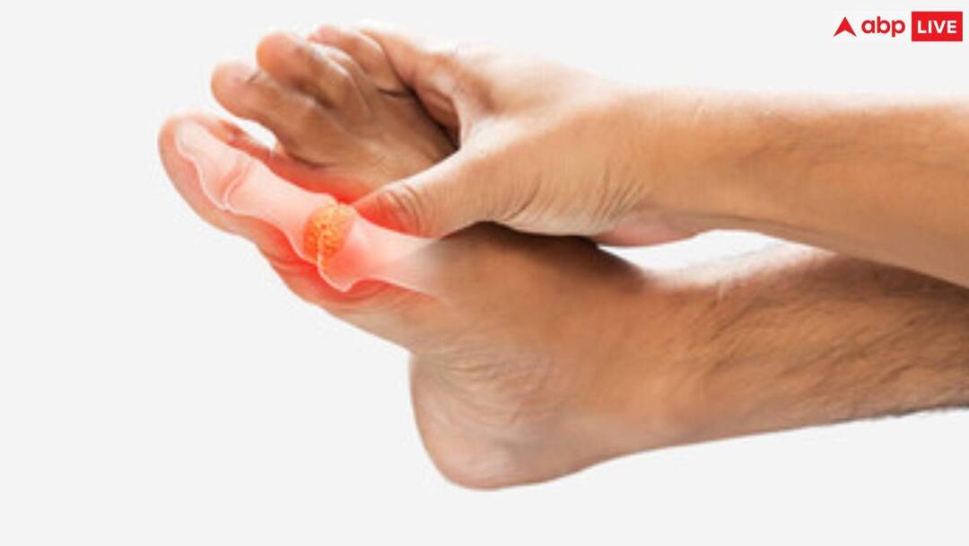 uric acid and want to control it without medicines then drink this homemade juice High Uric Acid: हाई यूरिक एसिड क्या है? जोड़ों में जमे प्यूरीन को बाहर निकालने के लिए पिएं ये जूस