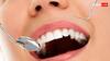 Teeth Regrowth: बचपन में ही नहीं 25-30 की उम्र में उगेंगे दांत, आ रही ऐसी दवा