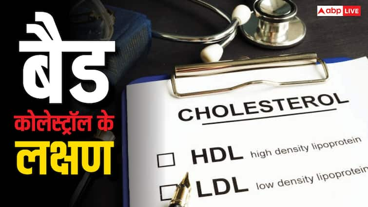 This is the most important sign of cholesterol buildup in the veins; ignoring it can be costly.