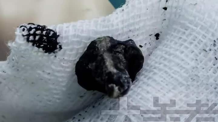 हाल ही के दिनों में जब बच्चे को तकलीफ होने लगी और उसकी शिकायतें बढ़ने लगीं तो उसके मां बाप उसे डॉक्टर के पास ले गए. जब उसके नथुने की जांच की गई तो डॉक्टर के भी होश उड़ गए.