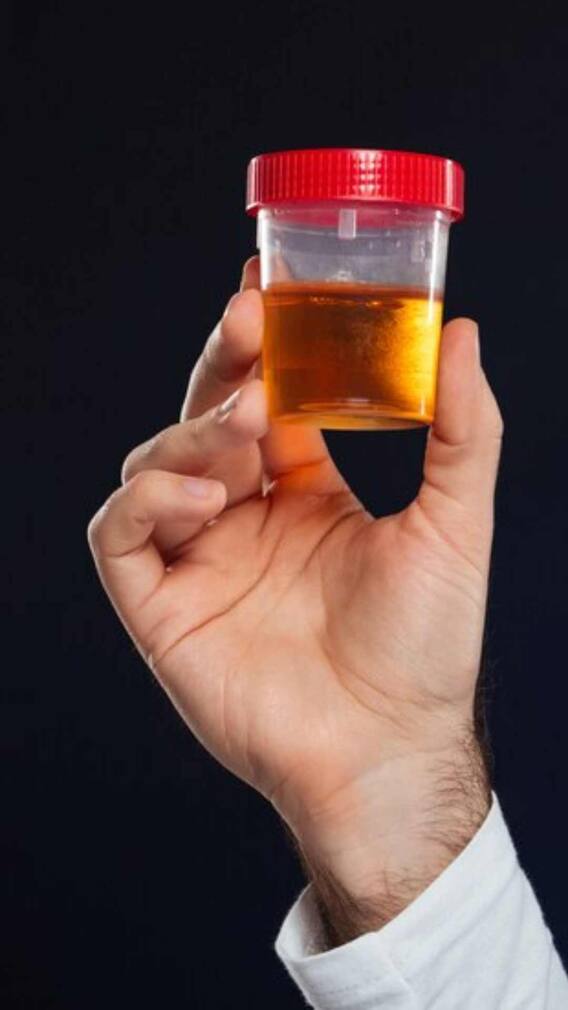 ਪੇਸ਼ਾਬ ਦੀ ਬਦਬੂ ਤੇ ਰੰਗ ਨਾਲ ਜਾਣੋ ਸਿਹਤ ਦੀ ਹਾਲਤ, ਸਮੇਂ ਰਹਿੰਦੇ ਕਰਵਾਓ ਇਲਾਜ