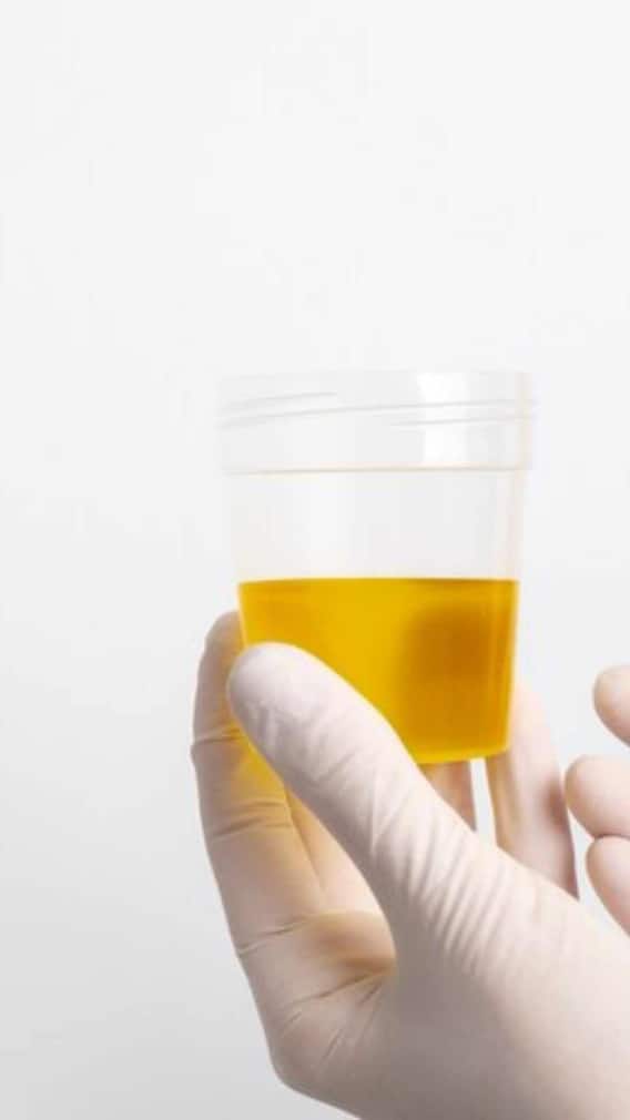 દિવસમાં કેટલી વાર પેશાબ જવું સામાન્ય છે?