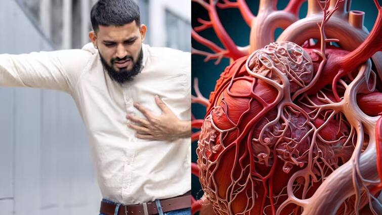 atherosclerosis aka clogged arteries causes and symptoms and complications and diet tips Clogged Arteries: ஆண்களே டார்கெட்..! இதய தமனியில் அடைப்பு ஏற்பட காரணம் என்ன? தடுப்பது எப்படி? முழு விவரம் இதோ..!