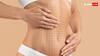 Liposuction: क्या वेटलॉस के लिए लिपोसक्शन कराना सही है, जानिए रिस्क और साइड इफेक्ट्स
