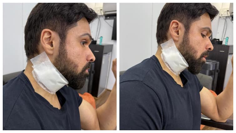 Emraan Hashmi को लगी गंभीर चोट, एक्शन सीन सूट करते समय गर्दन में लगा बड़ा घाव, फोटो देख फैंस हुए परेशान emraan hashmi injured during shooting of godachari 2 action scene Emraan Hashmi को लगी गंभीर चोट, एक्शन सीन सूट करते समय गर्दन में लगा बड़ा घाव, फोटो देख फैंस हुए परेशान
