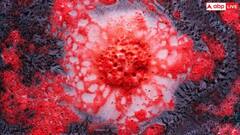 Marburg Virus: ਦੁਨੀਆ ਦੇ ਸਭ ਤੋਂ ਖਤਰਨਾਕ ਵਾਇਰਸ ਮਾਰਬਰਗ  ਨਾਲ 12 ਤੋਂ ਵੱਧ ਲੋਕਾਂ ਦੀ ਮੌਤ, ਜਾਣੋ ਇਸਦੇ ਲੱਛਣ