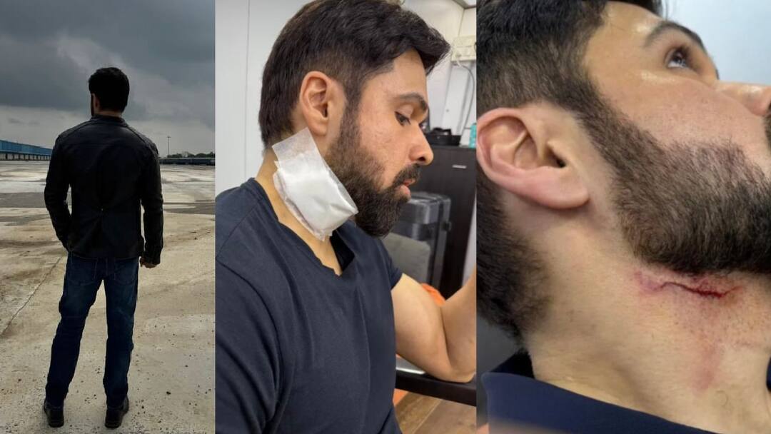 Emraan Hashmi gets injured while shooting for Adivi Sesh G2 Goodachari 2 Emraan Hashmi: తృటిలో ప్రాణాలతో బయటపడ్డ ఇమ్రాన్ హష్మీ... ‘గూఢచారి 2’ సెట్‌లో ప్రమాదం - ఇప్పుడు ఎలా ఉన్నారంటే?