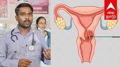 Doctor have said that women should get the HPV vaccine - TNN பெண்களே உஷார்...! நீங்க கட்டாயம் இந்த தடுப்பூசி செலுத்த வேண்டும் - மருத்துவர் எச்சரிக்கை