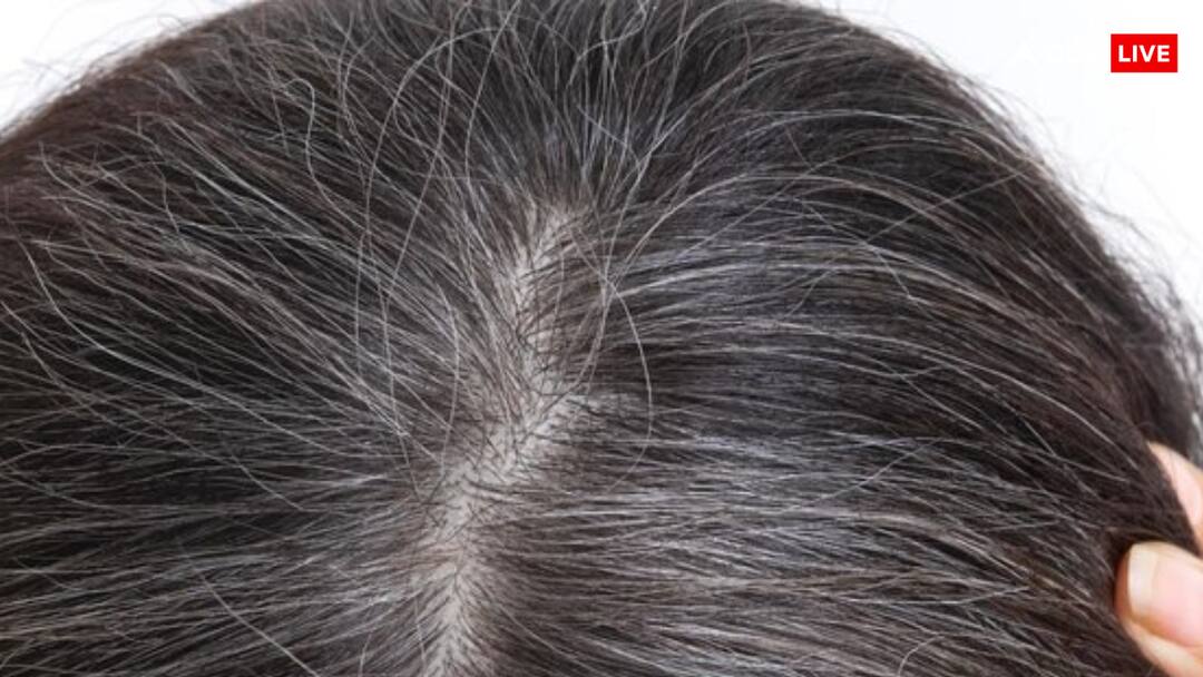 hair care tips premature hair graying causes in gen z and millennials Premature Hair Graying: समय से पहले ही सफेद हो रहे यंग जेनरेशन के बाल, जानें कारण और बचाव