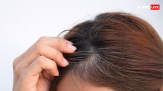 कम उम्र में सफेद बाल की वजह से झलकने लगा है बुढ़ापा शुरू कर दें ये काम