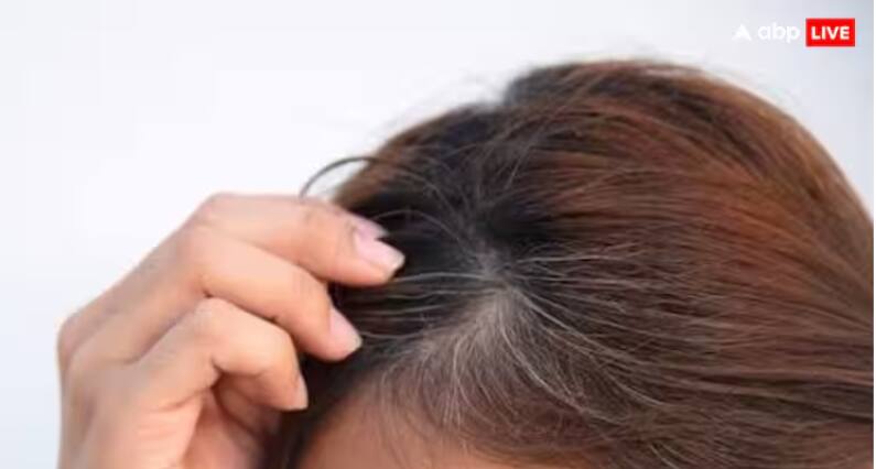 try-these-home-remedies-if-your-hair-turns-grey-prematurely ਤੁਹਾਡੇ ਵੀ ਸਮੇਂ ਤੋਂ ਪਹਿਲਾਂ ਵਾਲ ਹੋ ਗਏ ਚਿੱਟੇ, ਤਾਂ ਅੱਜ ਤੋਂ ਹੀ ਸ਼ੁਰੂ ਕਰ ਦਿਓ ਆਹ ਕੰਮ, ਜਲਦੀ ਮਿਲੇਗੀ ਨਤੀਜਾ