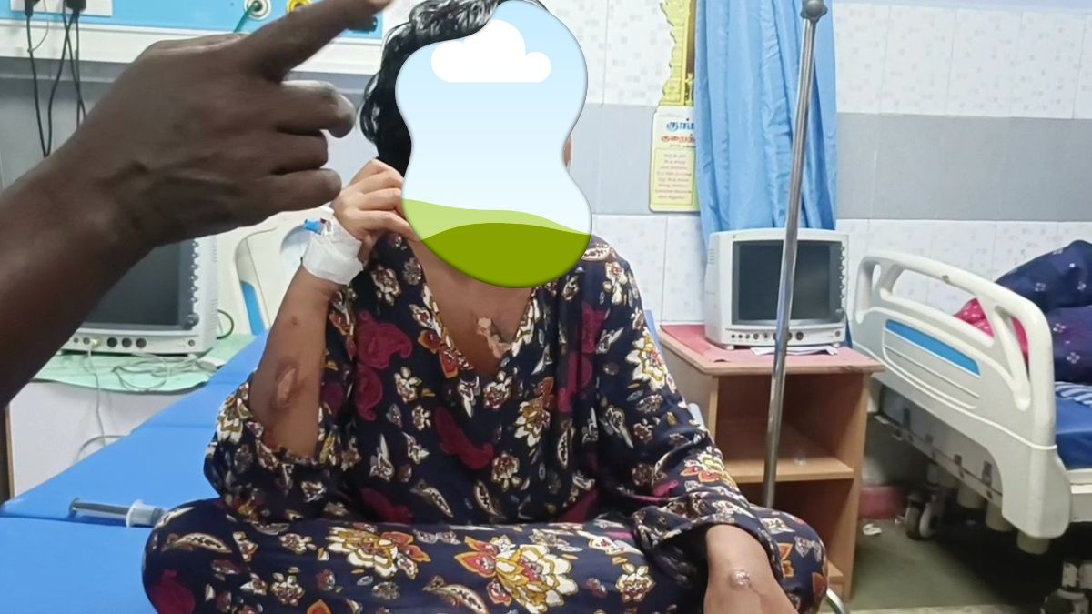 ”நெஞ்சில் ஈரமே இல்லையா?” மகள் உடல் முழுவதும் சூடு வைத்த தந்தை ; தகவல் சொன்ன மக்கள்..!
