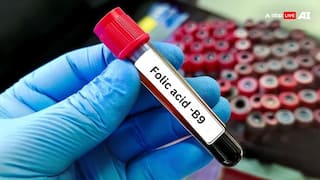 फोलिक एसिड की कमी से हो सकती है ये बीमारी, जानें क्या है इसका सबसे बड़ा सोर्स