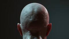 गंजा कहने पर हो जाएगी जेल! कर्मचारी की शिकायत पर अदालत ने लगाई बॉस को लताड़