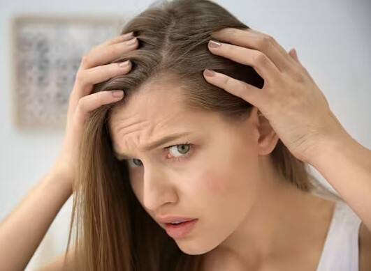 આ કારણે થાય છે નાની ઉંમરમાં વાળ સફેદ, જાણો બચવાના ઉપાય This causes white hair at a young age આ કારણે થાય છે નાની ઉંમરમાં વાળ સફેદ, જાણો બચવાના ઉપાય