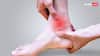 Sprained Foot: पैरों में मोच आ जाए तो 5 देसी उपाय अपनाएं, तुरंत मिलेगा आराम