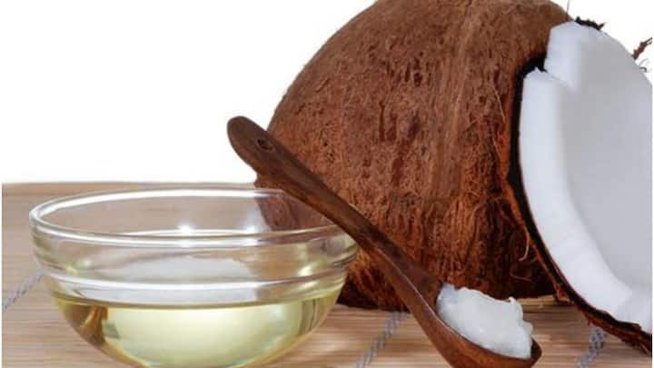 2. Coconut Oil: Coconut oil is good for the skin, providing deep hydration and nourishment. Its antibacterial and anti-inflammatory properties help soothe dry, itchy skin, fight infection and promote a smooth, glowing complexion. (Image Source: Pinterest/stylecraze)