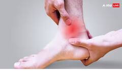 Sprained Foot: જો તમારા પગમાં મચકોડ આવી ગઈ હોય તો આ 5 ઘરગથ્થુ ઉપચાર અપનાવો, તમને તરત જ રાહત મળશે