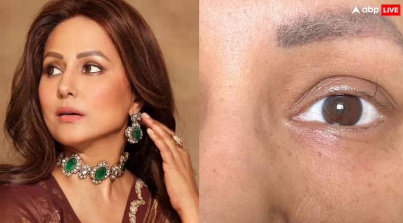 hina-khan-cancer-last-chemotherapy-left-single-eyelash-motivation-source ਕੈਂਸਰ ਨਾਲ ਲੜ ਰਹੀ ਹਿਨਾ ਖਾਨ ਦੀਆਂ ਅੱਖਾਂ 'ਚ ਬਚੀ ਸਿਰਫ ਇੱਕ ਪਲਕ, ਫੋਟੋ ਸ਼ੇਅਰ ਕਰਕੇ ਦਿਖਾਇਆ ਆਪਣਾ ਹਾਲ, ਕੰਬ ਜਾਵੇਗੀ ਰੂਹ