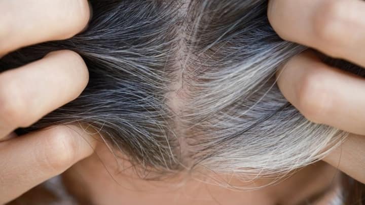 White Hair Prevention : తెల్లజుట్టు వివిధ కారణాలతో వస్తుంది. వయసు పెరిగేకొద్ది ఇది ఎక్కువ అవుతుంది. మరికొందరిలో బాల్యం నుంచే ఈ తెల్లజుట్టు వస్తు ఉంటుంది. దీనిని సహజంగా ఎలా తగ్గించుకోవచ్చో చూద్దాం.