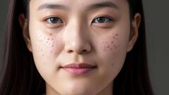 Pimples Homemade Remides: ঘরোয়া উপায়ে ব্রণ দূর করার সহজ উপায়